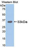 Suppression Of Tumorigenicity 14 antibody, LS-C305003, Lifespan Biosciences, Western Blot image 
