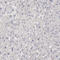Phospholipase A2 Group VI antibody, HPA001171, Atlas Antibodies, Immunohistochemistry paraffin image 