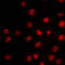T-Box 15 antibody, LS-C353116, Lifespan Biosciences, Immunofluorescence image 