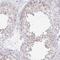 Proline And Serine Rich 3 antibody, NBP2-30902, Novus Biologicals, Immunohistochemistry paraffin image 