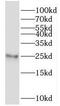 Mitochondrial Ribosomal Protein L24 antibody, FNab05323, FineTest, Western Blot image 