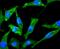 Choline acetyltransferase antibody, NBP2-66779, Novus Biologicals, Immunofluorescence image 