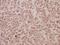 Ras-related protein Rab-5C antibody, A05148-1, Boster Biological Technology, Immunohistochemistry frozen image 