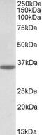 Neuroligin-4, X-linked antibody, 43-069, ProSci, Enzyme Linked Immunosorbent Assay image 
