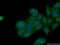 Akt antibody, 10176-2-AP, Proteintech Group, Immunofluorescence image 