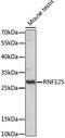 E3 ubiquitin-protein ligase RNF125 antibody, LS-C750138, Lifespan Biosciences, Western Blot image 
