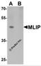 Muscular LMNA-interacting protein antibody, 6719, ProSci Inc, Western Blot image 