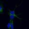 hVPS35 antibody, PA5-18248, Invitrogen Antibodies, Immunofluorescence image 
