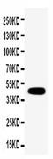 Gap Junction Protein Gamma 1 antibody, PA2206, Boster Biological Technology, Western Blot image 