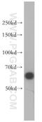 Histone Deacetylase 1 antibody, 10197-1-AP, Proteintech Group, Western Blot image 