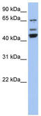 Vacuolar Protein Sorting 4 Homolog A antibody, TA334466, Origene, Western Blot image 