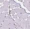 CDKN2A antibody, FNab02125, FineTest, Immunohistochemistry frozen image 