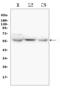 Solute Carrier Family 2 Member 6 antibody, A11862-1, Boster Biological Technology, Western Blot image 