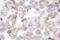 14-3-3 protein zeta/delta antibody, LS-C175907, Lifespan Biosciences, Immunohistochemistry paraffin image 