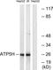 ATP synthase subunit d, mitochondrial antibody, GTX87685, GeneTex, Western Blot image 
