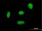 Zinc phosphodiesterase ELAC protein 2 antibody, H00060528-B01P, Novus Biologicals, Immunofluorescence image 