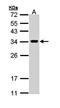 Vesicle-associated membrane protein-associated protein A antibody, orb73711, Biorbyt, Western Blot image 