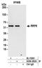 Ribosomal RNA-processing protein 8 antibody, A304-202A, Bethyl Labs, Immunoprecipitation image 