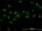 Double PHD Fingers 2 antibody, H00005977-M01, Novus Biologicals, Immunocytochemistry image 