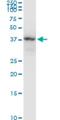 N-Acetylglucosamine Kinase antibody, H00055577-M05, Novus Biologicals, Western Blot image 