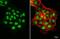 SS18L1 Subunit Of BAF Chromatin Remodeling Complex antibody, NBP2-20485, Novus Biologicals, Immunocytochemistry image 