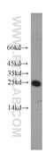 RAB5A, Member RAS Oncogene Family antibody, 11947-1-AP, Proteintech Group, Western Blot image 