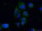 Vasohibin 2 antibody, 13303-1-AP, Proteintech Group, Immunofluorescence image 
