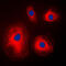 Ribosomal Protein S4 X-Linked antibody, GTX55889, GeneTex, Immunofluorescence image 