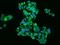 AHSG antibody, 205452-T02, Sino Biological, Immunohistochemistry frozen image 