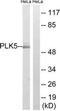 Polo Like Kinase 5 antibody, TA316078, Origene, Western Blot image 