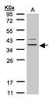 Purinergic Receptor P2Y13 antibody, GTX100380, GeneTex, Western Blot image 