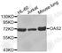 2'-5'-Oligoadenylate Synthetase 2 antibody, A3316, ABclonal Technology, Western Blot image 
