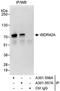 DDB1 And CUL4 Associated Factor 8 antibody, A301-557A, Bethyl Labs, Immunoprecipitation image 