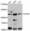 Stimulated by retinoic acid gene 6 protein homolog antibody, abx126670, Abbexa, Western Blot image 