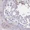 EPS8 Like 1 antibody, HPA043545, Atlas Antibodies, Immunohistochemistry paraffin image 