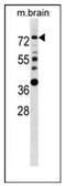 Estrogen Receptor 1 antibody, AP51464PU-N, Origene, Western Blot image 