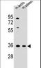 Ankyrin Repeat And SOCS Box Containing 17 antibody, LS-C156533, Lifespan Biosciences, Western Blot image 