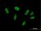 ZFP28 Zinc Finger Protein antibody, H00140612-B01P, Novus Biologicals, Immunofluorescence image 