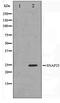 Synaptosome Associated Protein 25 antibody, TA347472, Origene, Western Blot image 