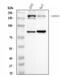 Protein strawberry notch homolog 1 antibody, A13130, Boster Biological Technology, Western Blot image 