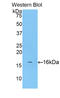 Calcitonin Related Polypeptide Beta antibody, LS-C299374, Lifespan Biosciences, Western Blot image 