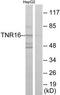 p75 ICD antibody, TA326223, Origene, Western Blot image 