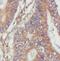 Angiomotin antibody, FNab09852, FineTest, Immunohistochemistry paraffin image 