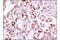 c-met antibody, 3077S, Cell Signaling Technology, Immunohistochemistry paraffin image 