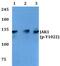 Janus Kinase 1 antibody, PA5-36657, Invitrogen Antibodies, Western Blot image 