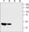 Potassium Voltage-Gated Channel Subfamily A Member 10 antibody, PA5-77652, Invitrogen Antibodies, Western Blot image 