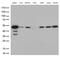 Cyclin Dependent Kinase 15 antibody, M12753-1, Boster Biological Technology, Western Blot image 