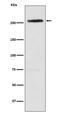 CAD protein antibody, M00463-1, Boster Biological Technology, Western Blot image 
