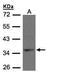 Cysteinyl Leukotriene Receptor 1 antibody, PA5-28735, Invitrogen Antibodies, Western Blot image 