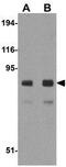 Albumin antibody, GTX85111, GeneTex, Western Blot image 